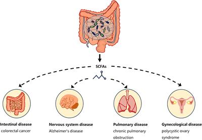 Effects of the gut microbiota and its metabolite short-chain fatty acids on endometriosis